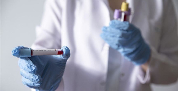 Virus potvrđen kod još 57 osoba u Republici Srpskoj