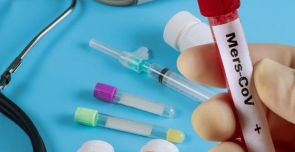 Kod još 140 osoba u Srpskoj otkriven virus korona