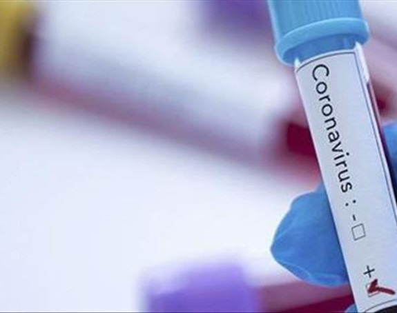 Kod još 85 osoba u Srpskoj potvrđen virus korona
