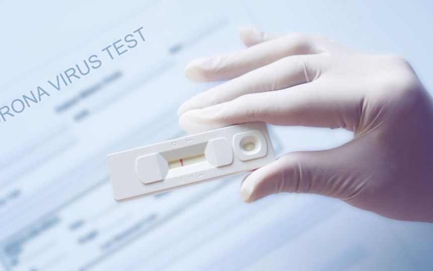 Vlasnik turističke agencije prodavao lažne PCR testove