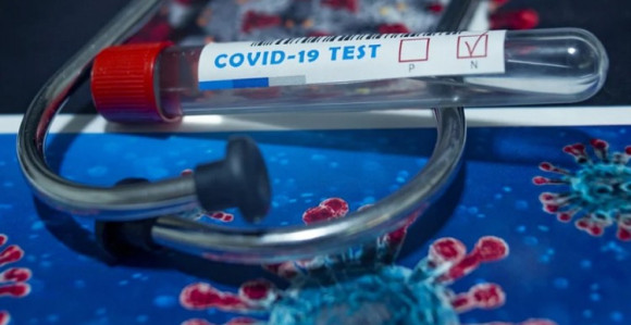 Sve veći broj zaraženih virusom korona u Srpskoj