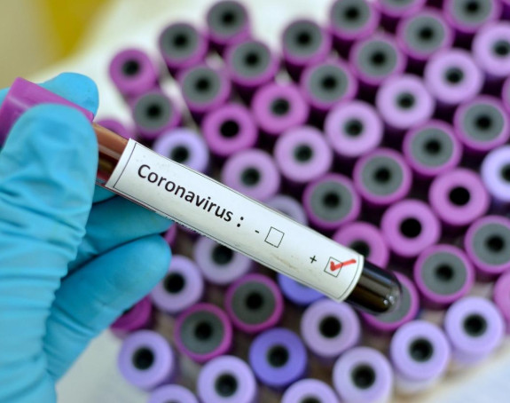 U FBiH zaraženo još 1.239 osoba, preminulo 36