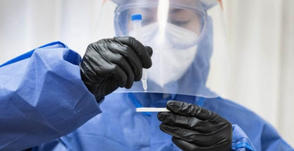 Više zaraženih u Srbiji, veliki broj smrtnih slučajeva