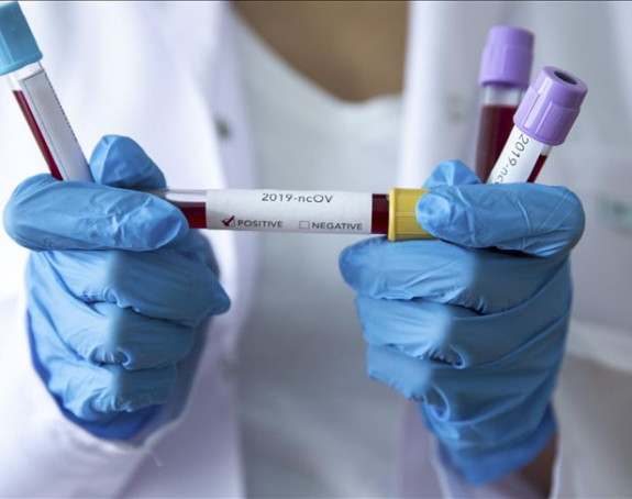 Virus korona potvrđen kod još 353 osobe