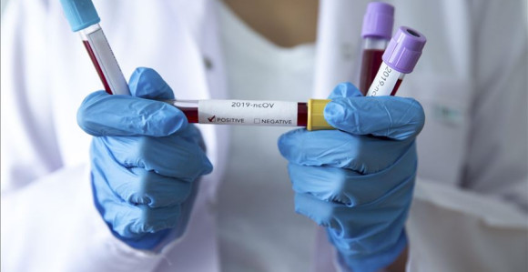 Virus korona potvrđen kod još 364 osobe, umrlo 25