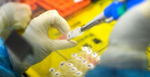 Zaraženo 110 osoba virusom korona u Republici Srpskoj