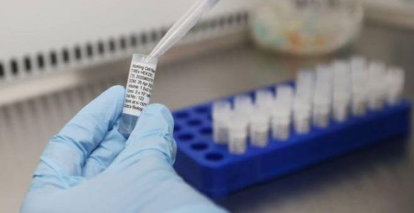 Srbija: Preminulo još 17 osoba, 787 zaraženih