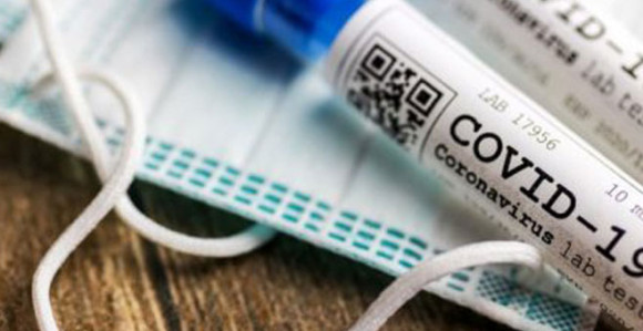 U Crnoj Gori preminulo pet lica, još 84 slučaja