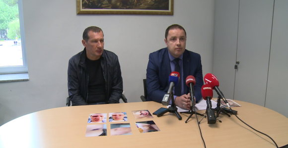 Trebinje: Sportski radnik na udaru policije