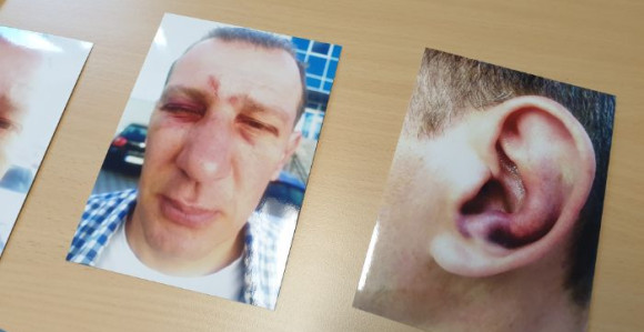 Policija vezala vozača i nanijela mu teške povrede
