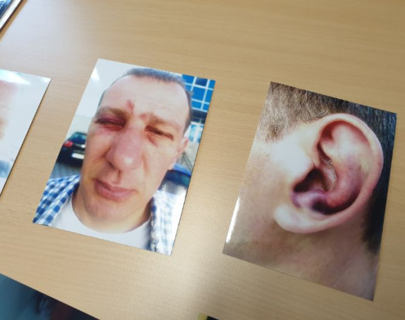 Полиција везала возача и нанијела му тешке повреде