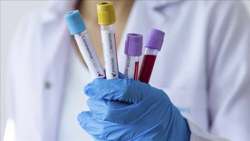 Prijavljeno 11 smrtnih slučajeva, još 70 zaraženih