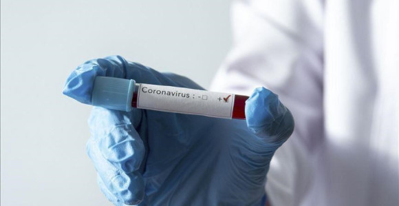 U Federaciji BiH zaraženo još 56 osoba koronom