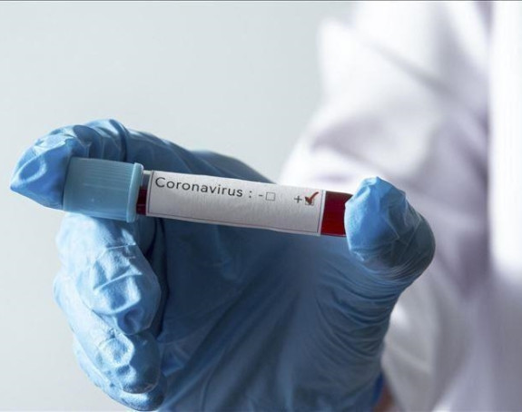 U Federaciji BiH 24 pozitivne osobe na virus koronu