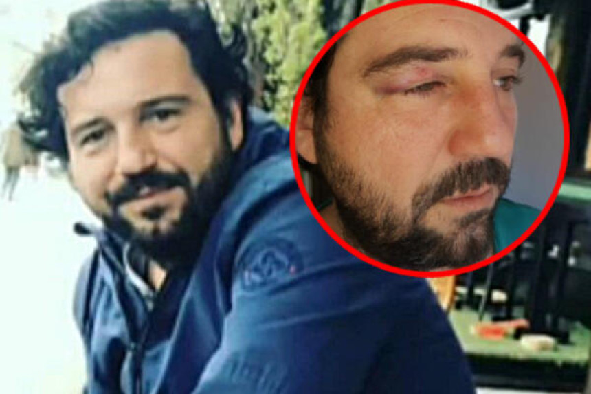 Глумца претукли због улоге негативца који тумачи у серији!
