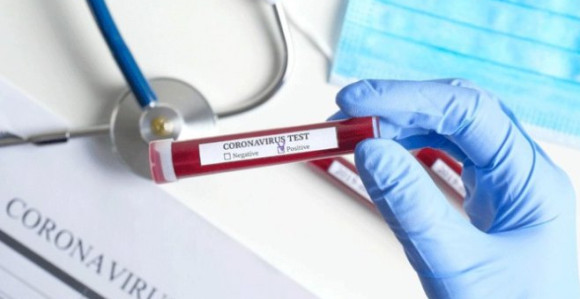 Virusom korona zaraženo 29 osoba u Republici Srpskoj