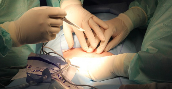 Doktor pozitivan na koronu operisao pacijente