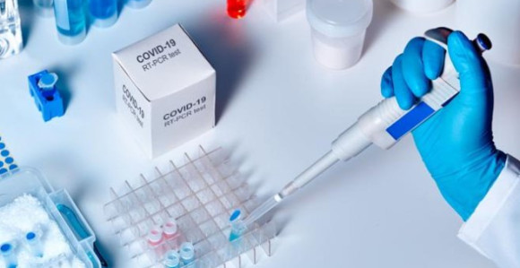 U Srbiji 110 novih slučajeva infekcije kovidom-19