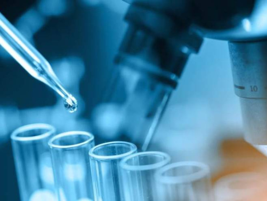 U Srbiji 77 zaraženih osoba virusom korona