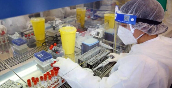 U Institutu u BL testiranje brzim antigenskim testovima