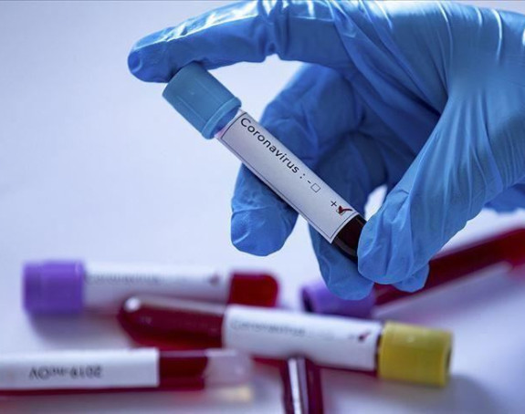 Srbija: Preminulo 5 osoba, nova 424 slučaja zaraze