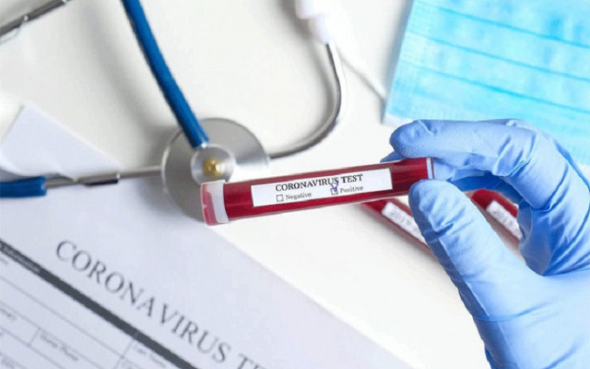 U Srpskoj nema preminulih, oboljelo još 14 osoba