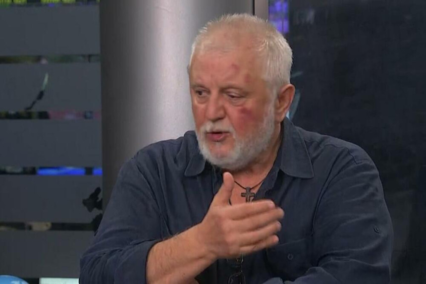 Antonijević se nakon tuče pojavio u programu uživo