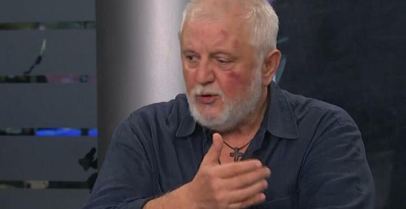 Antonijević se nakon tuče pojavio u programu uživo