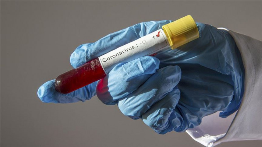 Još 471 osoba zaražena virusom korona u Srpskoj