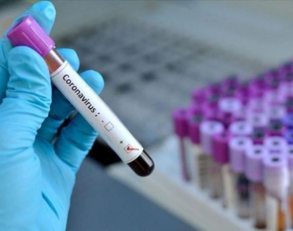 Virus korona potvrđen kod još 44 osobe u Srpskoj