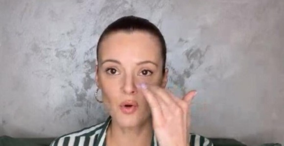 Slavica Ćukteraš o povredi: Mogla sam da ostanem bez oka!