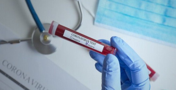 Osam preminulih u Srpskoj, više od 100 zaraženih