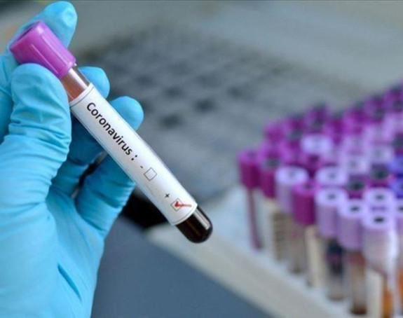 Pedeset osoba zaraženo virusom korona u Srpskoj