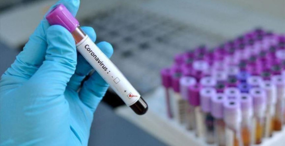Virus ne posustaje u Srpskoj, još 293 zaraženih
