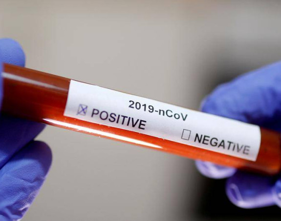 Virusom korona u Srpskoj zaraženo još 40 osoba