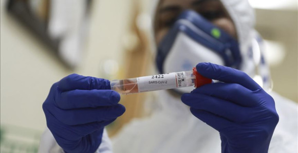 Korona u BiH: 92 novozaraženih, preminulo 12