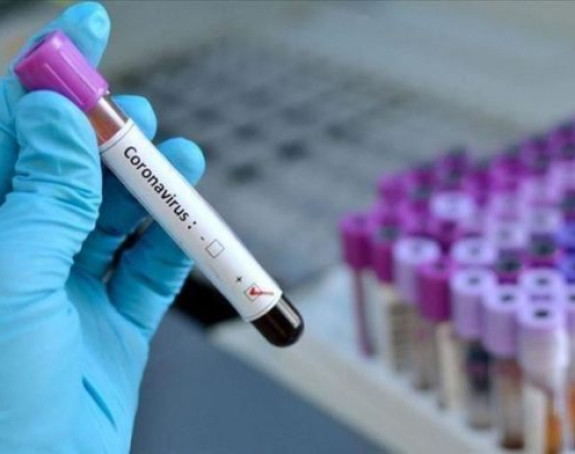 U Srpskoj 14 novih slučajeva zaraze koronom