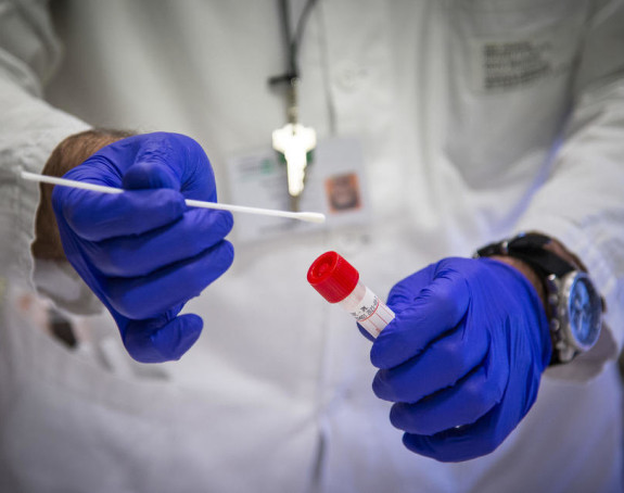 U Srpskoj još 151 osoba zaražena virusom korona