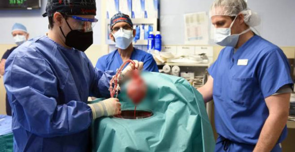 Prvi put u istoriji: Čovjeku presadili svinjsko srce