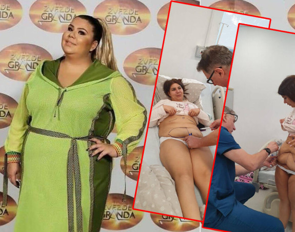 Imala je 160 kg, smršala 88 a sad ide na operaciju uklanjanja viška kože!