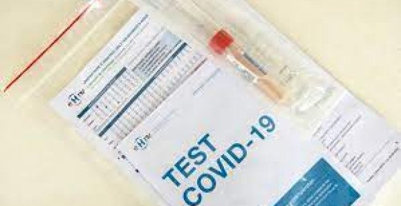 Srbija donirala Mostaru briseve za testiranje na virus