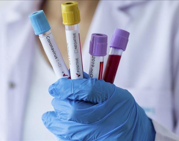 Вирусом корона заражене још 74 особе у Српској