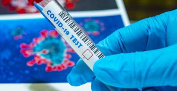 U Srpskoj 104 novozaražene osobe, troje preminulo