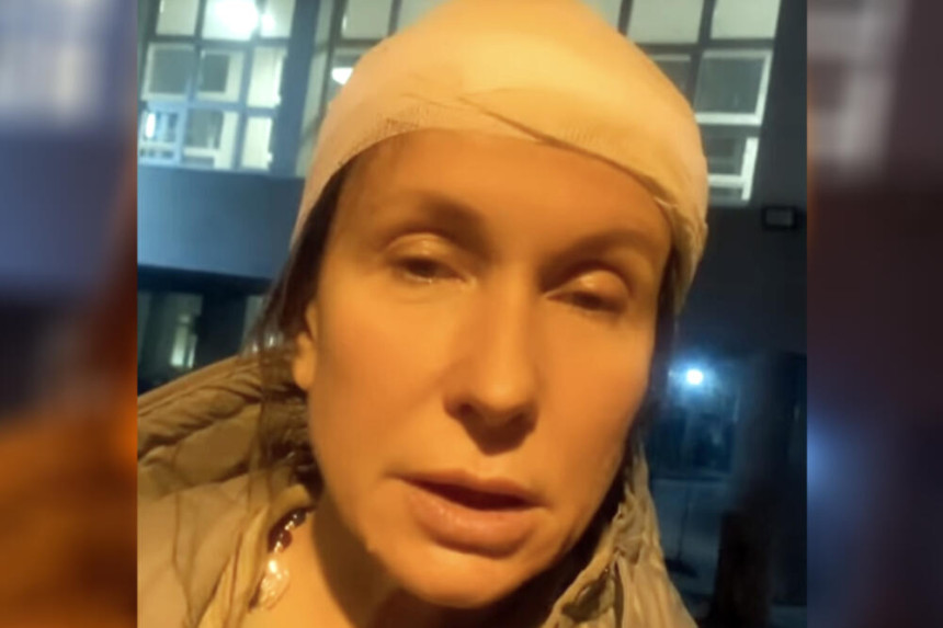 Voditeljka Snežana Dakić pogođena kamenom u glavu