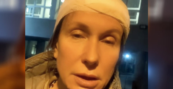 Voditeljka Snežana Dakić pogođena kamenom u glavu