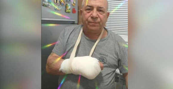Hasan Dudić završio u gipsu, oglasio se i otkrio šta se desilo!