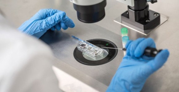 Rijetka virusna bolest u Evropi, a nema vakcina