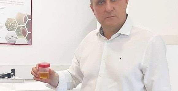 Doktor koji se testira na drogu i fotografiše urin