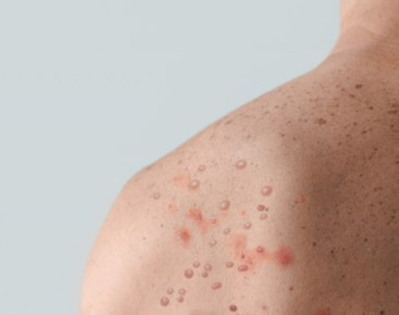 U Francuskoj haraju majmunske boginje