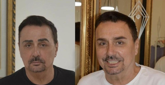 Keba se počastio novim obrvama od 600 evra!